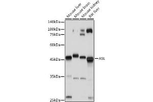 Western blot analysis of extracts of various cell lines, using ASL antibody (ABIN6127448, ABIN6137201, ABIN6137202 and ABIN6221972) at 1:1000 dilution. (ASL 抗体  (AA 1-300))