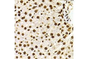 Immunohistochemistry of paraffin-embedded Rat liver using H3K27me2 antibody at dilution of 1:100 (x400 lens). (Histone 3 抗体  (H3K27me))