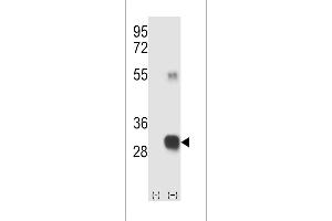 Western blot analysis of RCE1 (arrow) using rabbit polyclonal RCE1 Antibody (W57) (ABIN389050 and ABIN2839259). (RCE1/FACE2 抗体  (N-Term))