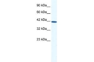WB Suggested Anti-SOX11 Antibody Titration: 0. (SOX11 抗体  (N-Term))