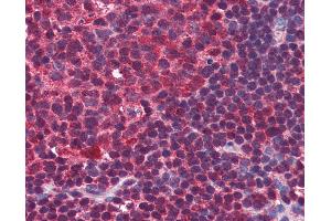 Anti-BLIMP-1 antibody IHC of human colon, lymphoid follicle. (PRDM1 抗体  (C-Term))
