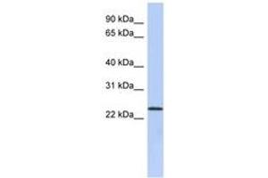 Image no. 1 for anti-UL16 Binding Protein 1 (ULBP1) (N-Term) antibody (ABIN6743537) (ULBP1 抗体  (N-Term))
