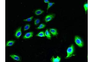 Immunofluorescent analysis of A549 cells using ABIN7165209 at dilution of 1:100 and Alexa Fluor 488-congugated AffiniPure Goat Anti-Rabbit IgG(H+L) (CNIH2 抗体  (AA 94-138))