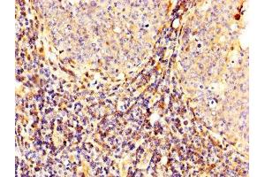 IHC image of ABIN7146540 diluted at 1:300 and staining in paraffin-embedded human tonsil tissue performed on a Leica BondTM system. (Calpain 2 抗体  (Catalytic Subunit))