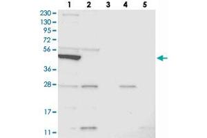 Western blot analysis of Lane 1: RT-4, Lane 2: U-251 MG, Lane 3: Human Plasma, Lane 4: Liver, Lane 5: Tonsil with SLC10A3 polyclonal antibody . (SLC10A3 抗体)
