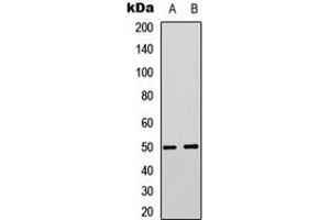 Western blot analysis of MCT4 expression in Jurkat (A), PC3 (B) whole cell lysates. (SLC16A3 抗体  (Center))