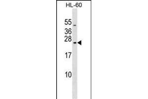 RAB20 Antibody (C-term) (ABIN1536837 and ABIN2849183) western blot analysis in HL-60 cell line lysates (35 μg/lane). (RAB20 抗体  (C-Term))