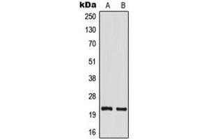 Western blot analysis of TM2D1 expression in MCF7 (A), mouse kidney (B) whole cell lysates.