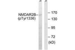 Western blot analysis of extracts from Jurkat cells treated with TNF 20ng/ml 30', using NMDAR2B (Phospho-Tyr1336) Antibody. (GRIN2B 抗体  (pTyr1336))