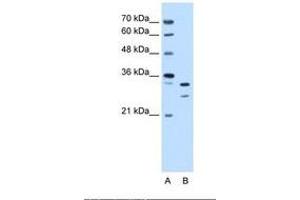 Image no. 2 for anti-Acidic (Leucine-Rich) Nuclear phosphoprotein 32 Family, Member E (ANP32E) (AA 151-200) antibody (ABIN6738242) (ANP32E 抗体  (AA 151-200))