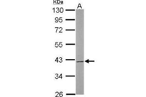 Western Blotting (WB) image for anti-SUMO1 Activating Enzyme Subunit 1 (SAE1) antibody (ABIN2856922)