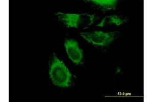 Immunofluorescence of purified MaxPab antibody to KRT7 on HeLa cell. (Cytokeratin 7 抗体  (AA 1-469))