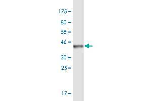 Western Blot detection against Immunogen (36. (GLI1 抗体  (AA 401-500))