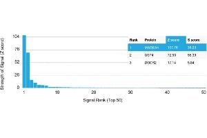 Analysis of Protein Array containing more than 19,000 full-length human proteins using MAGEA4 Mouse Monoclonal Antibody (CPTC-MAGEA4-1). (MAGEA4 抗体)