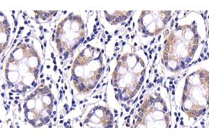 Detection of CASP9 in Human Colon Tissue using Polyclonal Antibody to Caspase 9 (CASP9) (Caspase 9 抗体  (AA 331-416))