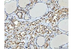 IHC analysis of TTLL12 using anti-TTLL12 antibody (ABIN7602497). (TTLL12 抗体  (AA 8-634))