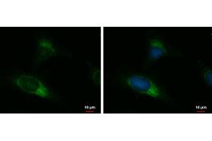 ICC/IF Image UGCGL2 antibody [N3C2], Internal detects UGCGL2 protein at endoplasmic reticulum by immunofluorescent analysis.