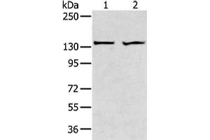 Gel: 6 % SDS-PAGE, Lysate: 40 μg, Lane 1-2: A431 and 293T cell, Primary antibody: ABIN7189660(ADAMTS2 Antibody) at dilution 1/200 dilution, Secondary antibody: Goat anti rabbit IgG at 1/8000 dilution, Exposure time: 1 minute (Adamts2 抗体)