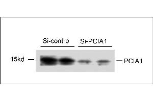 Western blot analysis of extracts from 293T cells that were transfected with si-control or transfected si-PCIA1, using rabbit polyclonal PCIA1 Antibody (Center) (ABIN658015 and ABIN2846953). (DDA1 抗体  (AA 11-40))