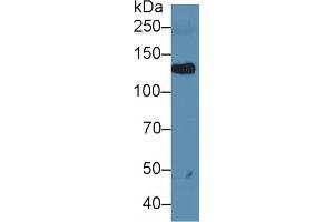 Western blot analysis of Rat Serum, using Rat LIFR Antibody (1 µg/ml) and HRP-conjugated Goat Anti-Rabbit antibody ( (LIFR 抗体  (AA 382-486))