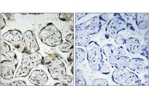 Immunohistochemistry analysis of paraffin-embedded human placenta tissue, using MT-ND1 Antibody. (MT-ND1 抗体  (AA 176-225))
