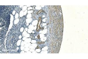 IHC analysis of H Cadherin/CDH13 using anti-H Cadherin/CDH13 antibody (ABIN7600095). (Cadherin 13 抗体  (AA 149-692))