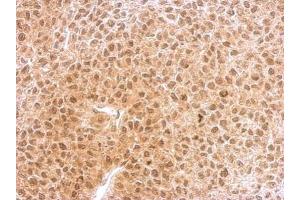 IHC-P Image RNF25 antibody [C2C3], C-term detects RNF25 protein at nucleus and cytosol on HeLa xenograft by immunohistochemical analysis. (RNF25 抗体  (C-Term))
