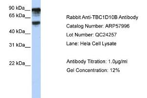 WB Suggested Anti-TBC1D10B  Antibody Titration: 0. (TBC1D10B 抗体  (C-Term))