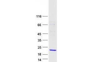 Western Blotting (WB) image for Wilms Tumor 1 Associated Protein (WTAP) (Transcript Variant 3) protein (Myc-DYKDDDDK Tag) (ABIN2735641)