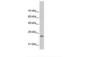 Image no. 2 for anti-Transcription Factor MafB (MAFB) (AA 41-90) antibody (ABIN6736309) (MAFB 抗体  (AA 41-90))