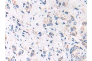 Immunohistochemistry (IHC) image for anti-Enoyl Coenzyme A Hydratase 1, Peroxisomal (ECH1) (AA 1-328) antibody (ABIN7443788)