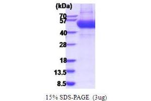 SDS-PAGE (SDS) image for Interleukin 13 Receptor, alpha 1 (IL13RA1) (AA 22-343) protein (His tag) (ABIN5854209) (IL13 Receptor alpha 1 Protein (AA 22-343) (His tag))