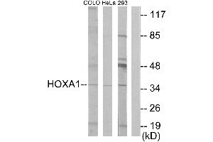 Western blot analysis of extracts from COLO cells, HeLa/ cells and 293 cells, using HOXA1 antibody. (HOXA1 抗体  (Internal Region))