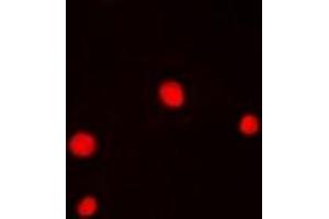 Immunofluorescent analysis of GABPB1 staining in Hela cells. (GABPB1 抗体)
