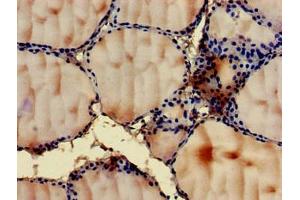 Immunohistochemistry of paraffin-embedded human thyroid tissue using ABIN7144546 at dilution of 1:100 (GIT1 抗体  (AA 470-642))