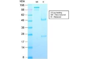 SDS-PAGE Analysis Purified Growth Hormone Recombinant Mouse Monoclonal (rGH/1450). (Recombinant Growth Hormone 1 抗体  (AA 58-187))