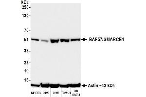 Western Blotting (WB) image for anti-SWI/SNF Related, Matrix Associated, Actin Dependent Regulator of Chromatin, Subfamily E, Member 1 (SMARCE1) (C-Term) antibody (ABIN7795731)
