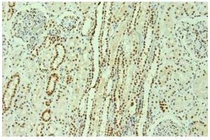 Image no. 3 for anti-Heterogeneous Nuclear Ribonucleoprotein L (HNRNPL) antibody (ABIN108560) (HNRNPL 抗体)