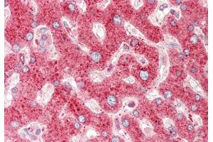 Immunohistochemistry (IHC) image for anti-Cysteine-Rich Protein 1 (Intestinal) (CRIP1) (N-Term) antibody (ABIN2784545)