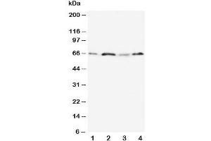 Western blot testing of OPN antibody and Lane 1:  MM231;  2: HeLa;  3: Jurkat;  4: COLO320 cell lysate. (Osteopontin 抗体  (N-Term))