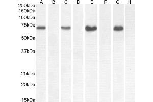 Western Blotting (WB) image for anti-NADPH Oxidase 1 (NOX1) (Internal Region) antibody (ABIN768583)