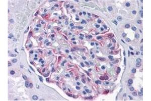 Immunohistochemistry (IHC) image for anti-Solute Carrier Family 44, Member 2 (SLC44A2) (AA 123-231) antibody (ABIN614725) (SLC44A2 抗体  (AA 123-231))