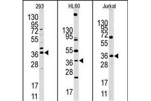 Western blot analysis of anti-HIF1AN (N-term) Pab in 293, HL60 and Jurkat cell line lysates. (HIF1AN 抗体  (N-Term))