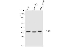 Western blot analysis of PAX4 using anti-PAX4 antibody (ABIN7602426).