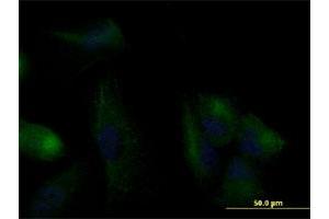 Immunofluorescence of monoclonal antibody to KRT20 on U-2 OS cell.