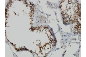 Immunoperoxidase of monoclonal antibody to POMZP3 on formalin-fixed paraffin-embedded human testis. (POMZP3 抗体  (AA 64-116))