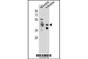 Western blot analysis in NCI-H292 cell line and mouse bladder tissue lysates (35ug/lane). (Goldenhar Syndrome 抗体  (C-Term))