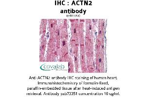 Image no. 1 for anti-Actinin, alpha 2 (ACTN2) (AA 215-500) antibody (ABIN1731491) (ACTN2 抗体  (AA 215-500))