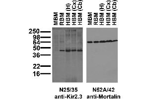 Immunoblot against crude membrane fractions from whole mouse (MBM) or rat (RBM) brain and from human hippocampus [HBM(H)], cerebral cortex [HBM(Cx)] or cerebellum [HBM(Cb)] and probed with N25/35 (left) or N52A/42 (right) TC supe.