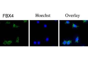Immunofluorescence staining of NIH/3T3 cells with FBX4 polyclonal antibody  . (FBXO4 抗体  (N-Term))